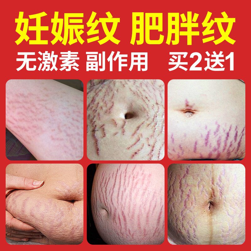 [瑞华轩御旗舫店身体乳,霜]孕妇擦妊去除肚子上的妊娠纹完好如初修月销量0件仅售88.19元