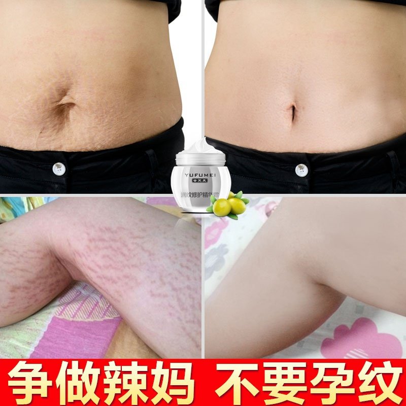 [瑞华轩御旗舫店身体乳,霜]去除大腿妊娠纹修复霜孕妇怀孕期身体乳月销量0件仅售88.09元