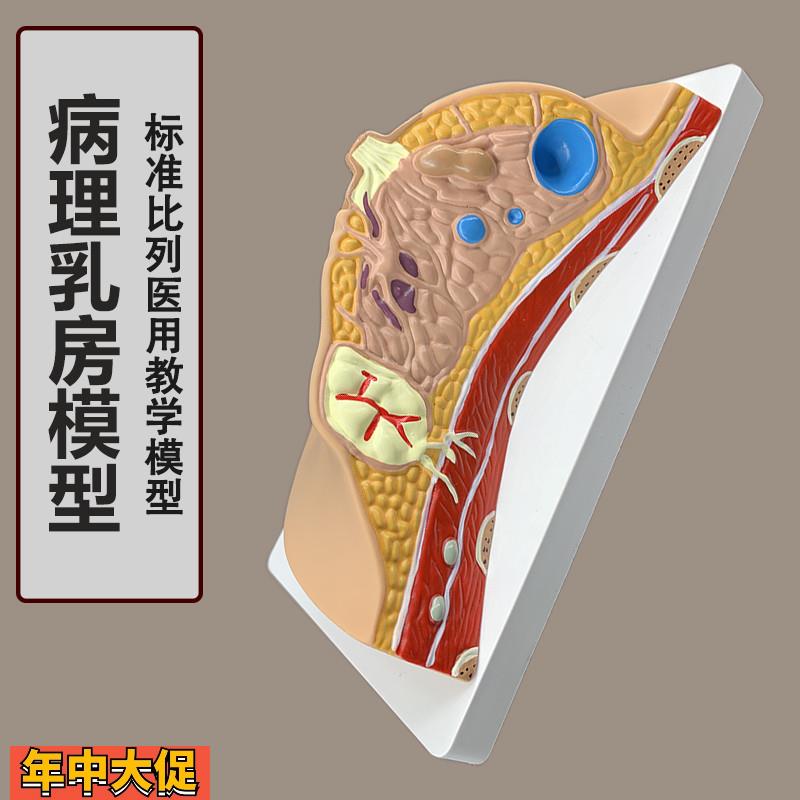 女性病理乳房模型人体1:1乳房模型乳腺解剖女性医院教学教具