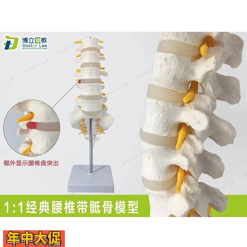 高端医用可拆成人5节腰椎尾骨模型脊椎椎间盘突出人体标本模型