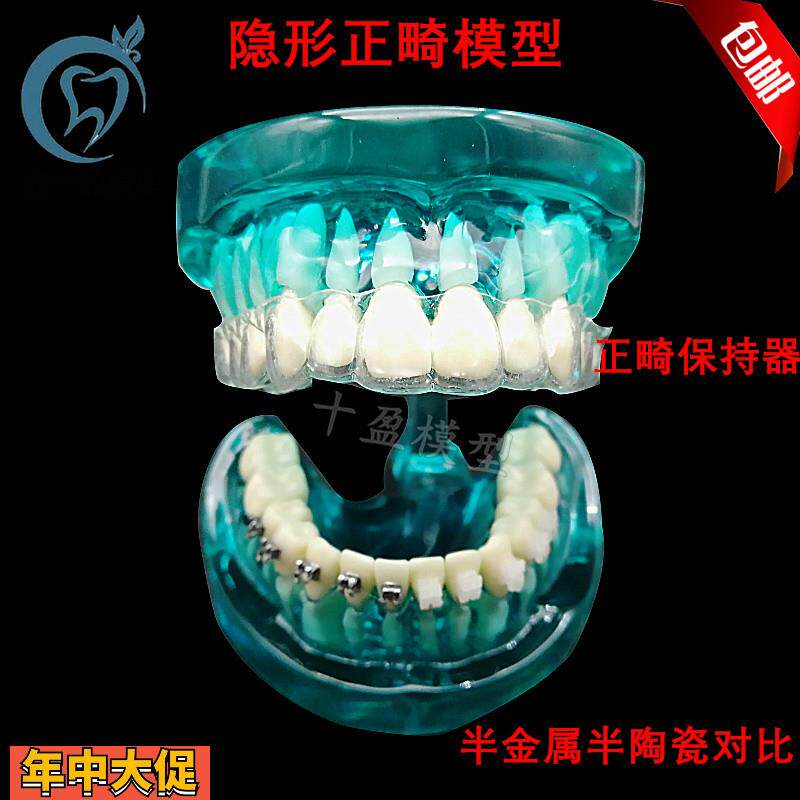 牙科隐形正畸模型正畸保持器示范正畸半金属半陶瓷托槽对比包邮