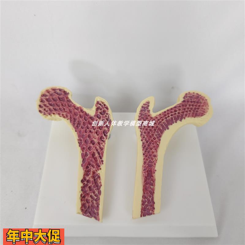 人体股骨头解剖模型骨质疏松切面解剖人类骨骼骨架解剖医讲解教具