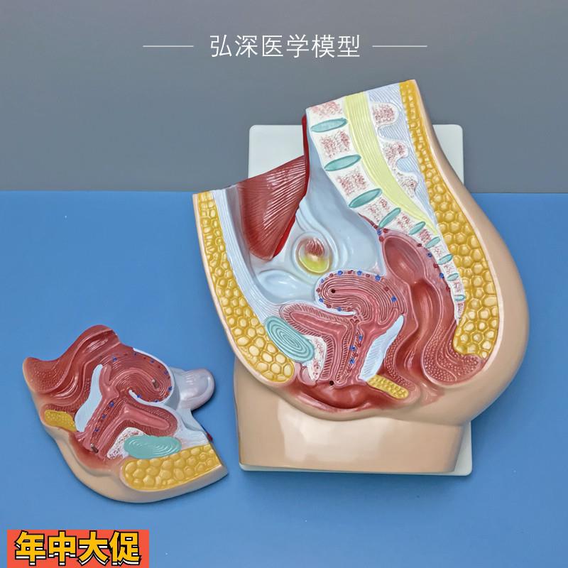 女性矢状解剖模型人体生殖系统腹部盆腔切面医学教学模具妇产教具