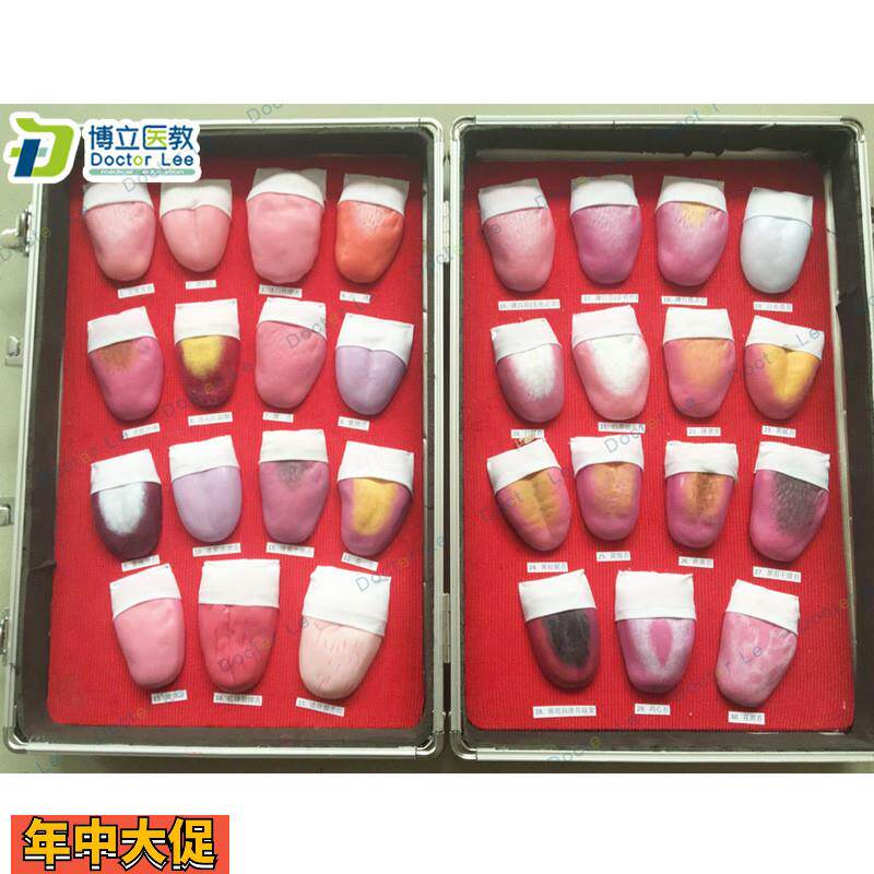 人体舌头舌苔常见病变比较模型口腔护理医用教学人体模型