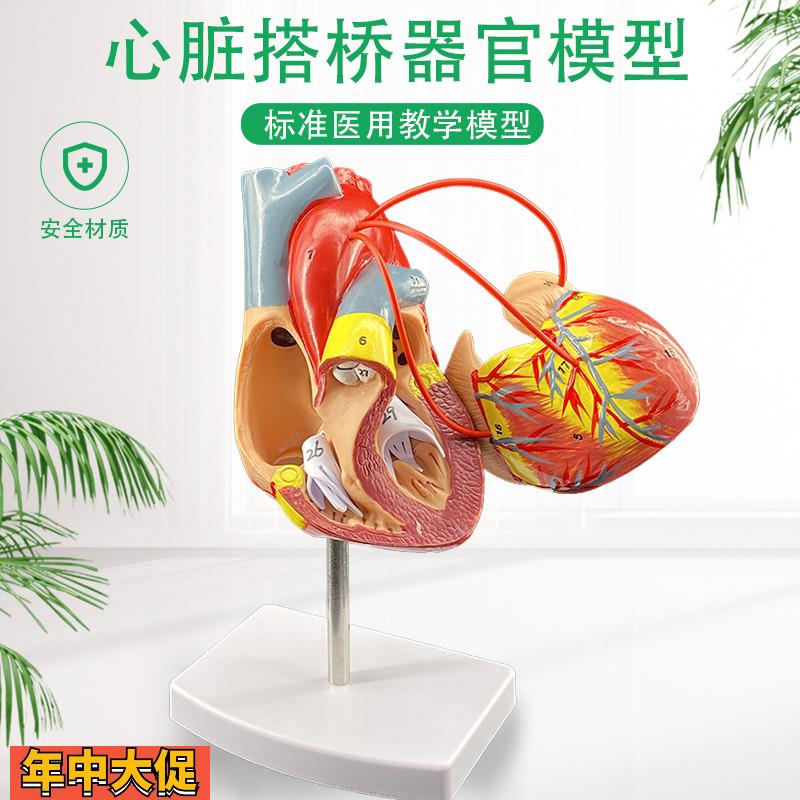 心脏搭桥模型人体器官结构层次解剖模型内脏医院学校教学演示模型