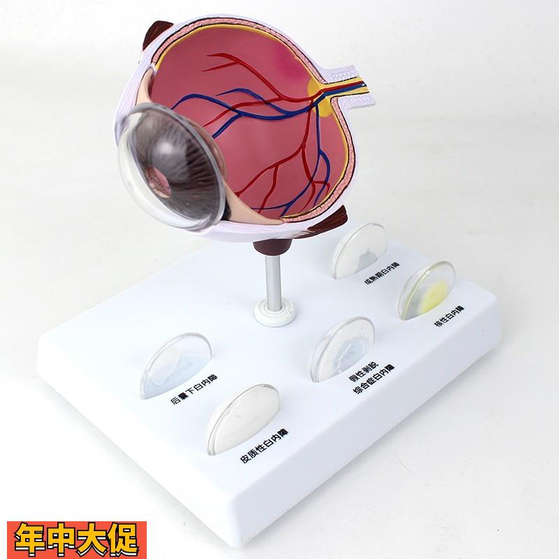 ENOVO颐诺人体眼球白内障眼疾病瞳孔眼球体眼珠晶体医学教具