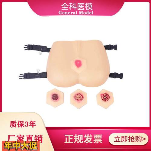 阶段褥疮护理模型压疮培训教具臀部模型医学教学用模型GM-RC-3