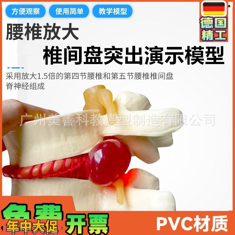 椎间盘模型正品医学人体腰椎突出脊柱脊椎骨病理演示关节标准模型