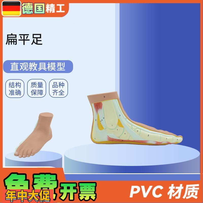 德国】PNT-0728扁平足直观教具平底足弓塌陷模型脚关节解剖模