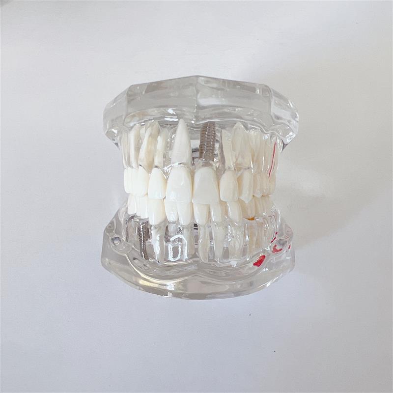 牙齿模型教学模型口腔材料假牙模型口腔模型病理修复模型工厂直销