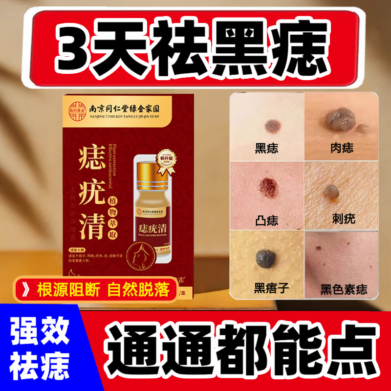 点痣祛痣药膏无痕点痦子去志取黑面部健康