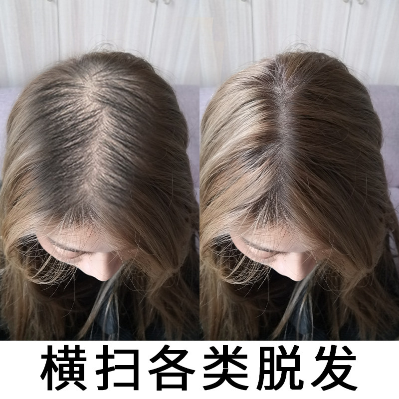 【同仁堂推荐】 头发自然生长速度 男女头发速度变密