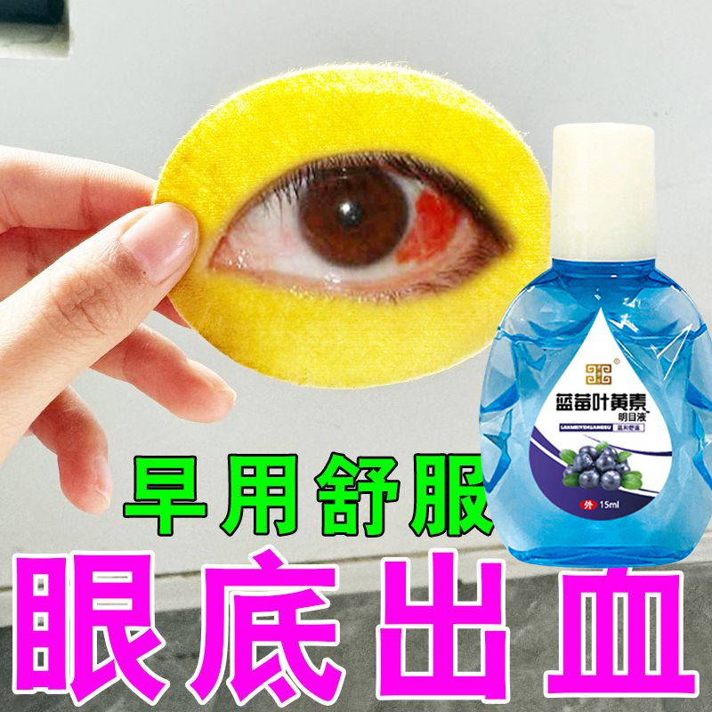 长期眼底出血滴眼液模糊不清眼睛红血丝胀痛有异物感反复磨眼流泪