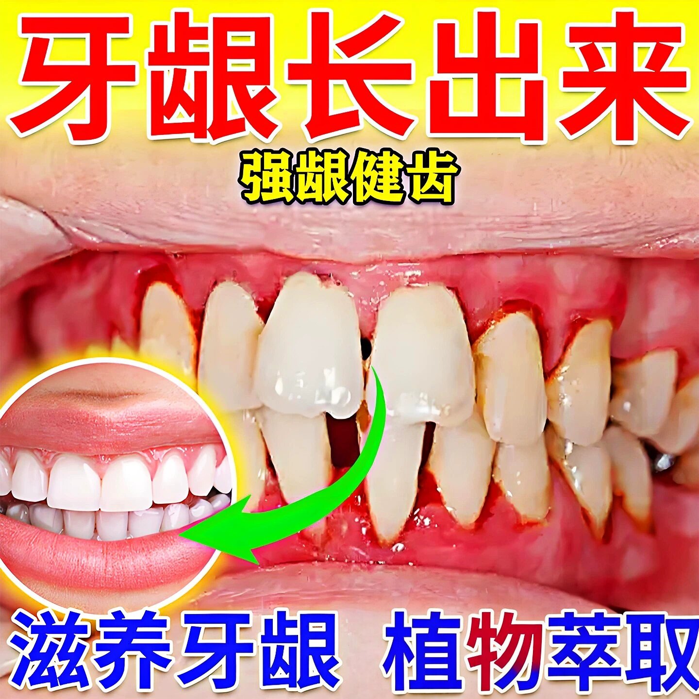 牙龈萎缩修复牙齿松动专用牙膏专皮肤消毒护理（消）