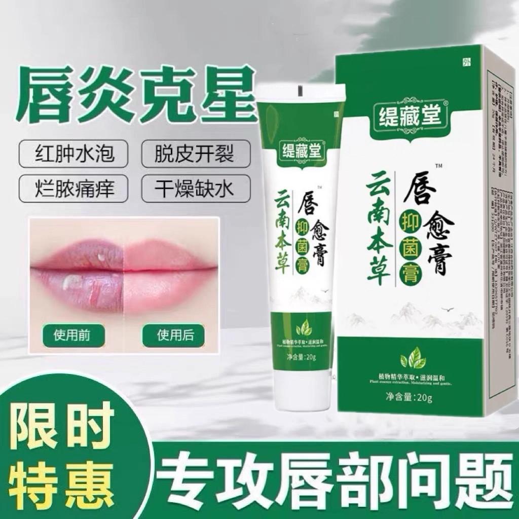 唇炎润唇膏专用嘴唇干裂