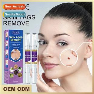 Skin Care Wart Remover Fading Mole Pen Hand Foot Face Neck F