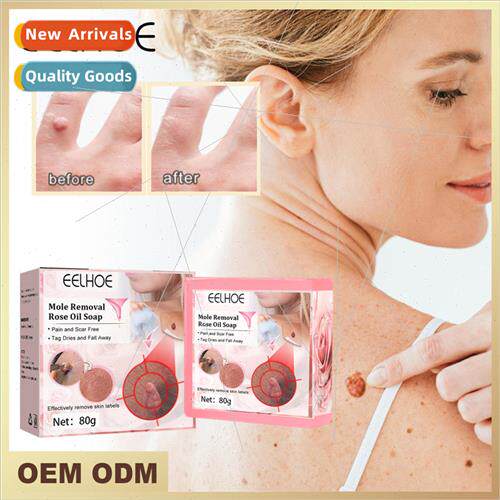 Rose Essential Soap 适用 Warts Mole Removal Warts Face Neck