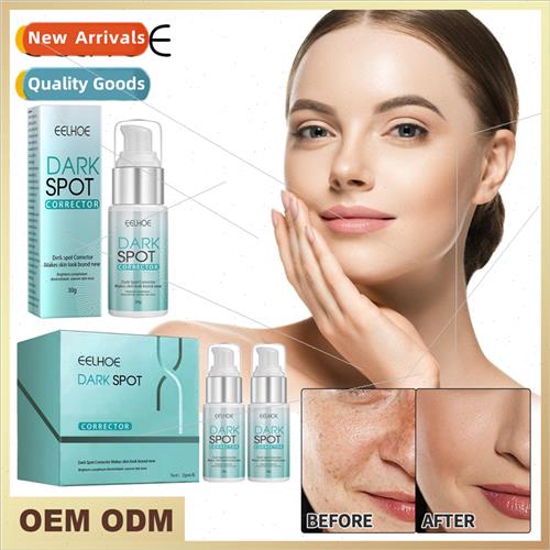 Dark  Cream Relieves Facial Skin Melanosis Facial Moisturizi