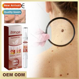 Wart Removal Pen Deep Cleansing Mole Flesh Repair Smoothing