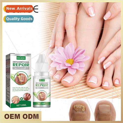 Gray Nail Repair Solution Nail Nutrient Solution Gray Nail B