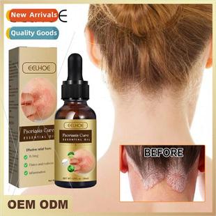 Essential Repair Oil Relieve Stop Skin Itchy Moss