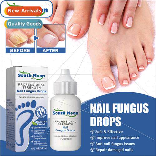 Nail Repair Drops Gray Nail Bad Nail Thickening Nail Soft Na