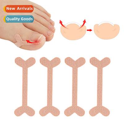 Improvement  ingrown toes nail groove stickers correct curly