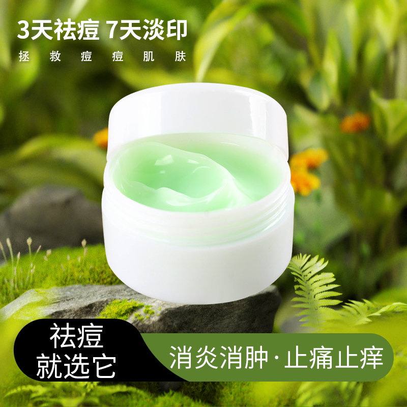 老款小绿瓶祛痘膏中药祛痘痘印粉刺痤疮止痛消肿修复防过敏