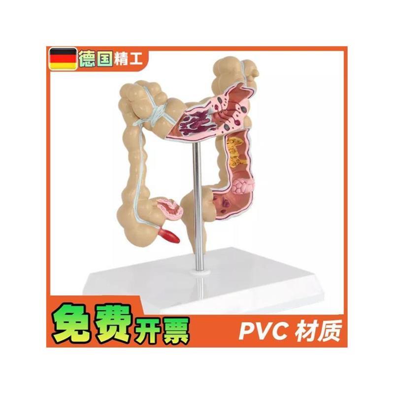 德国】仿真人体结肠大肠解剖模型肛肠科肠道肠胃消化系统教学