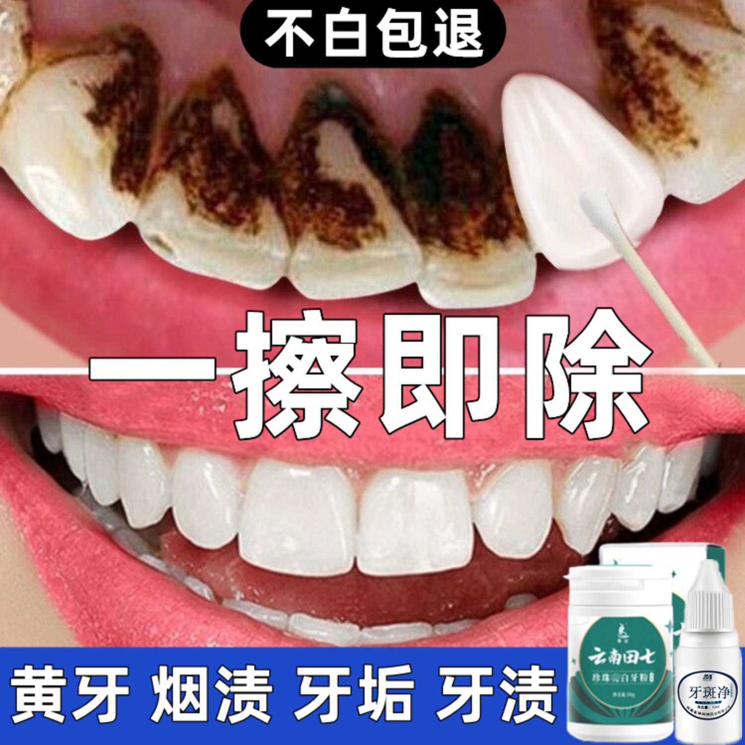 洗牙粉美白去黄牙齿污垢变白去除烟渍亮白清洁神器牙结石溶解速效