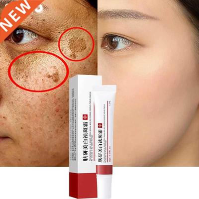Whitening Freckle Cream Remove Melasma Cream Remove Dark Spo