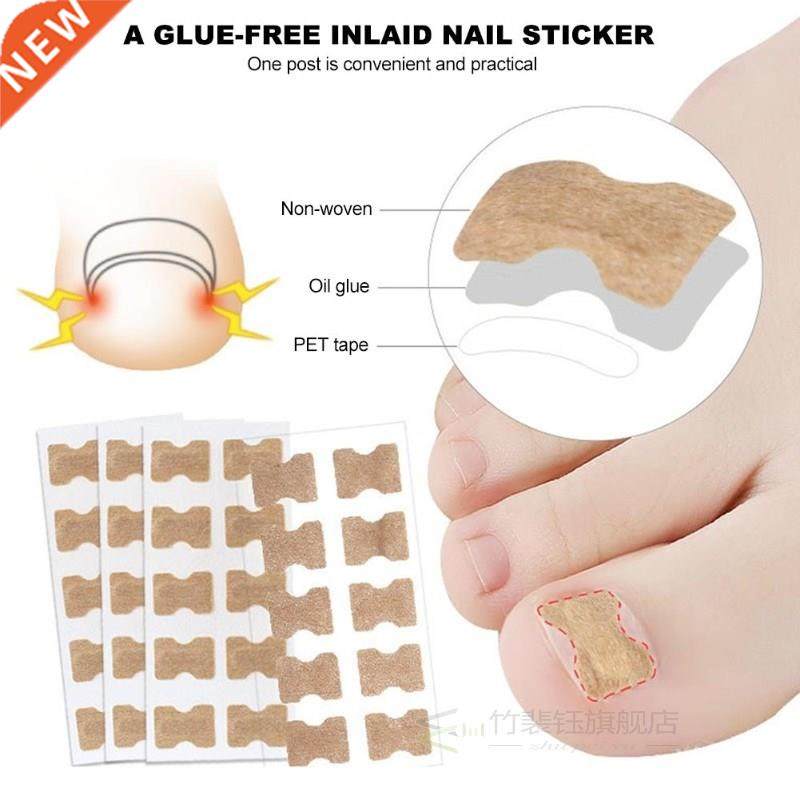 Ingrown Toenail Sticker Nail-Corrector Foot-Care Glue