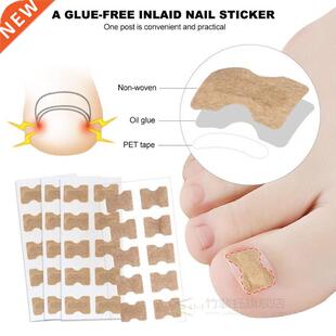 Ingrown Toenail Sticker Nail-Corrector Foot-Care Glue