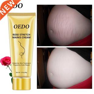 Pregnancy Scars Remove Stretch Marks Cream Treatment Materni