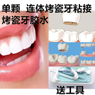 牙医动手粘烤瓷牙胶水牙齿钢牙套牙冠假牙胶水粘接剂牙科材料