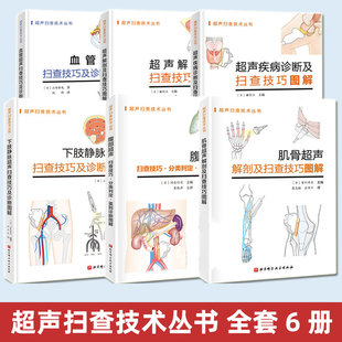 超声扫查技术丛书系列 超声解剖及扫查技巧图解 超声疾病诊断 血管超声 下肢静脉超声 腹部超声扫查技巧·分类判定·鉴别诊断图解
