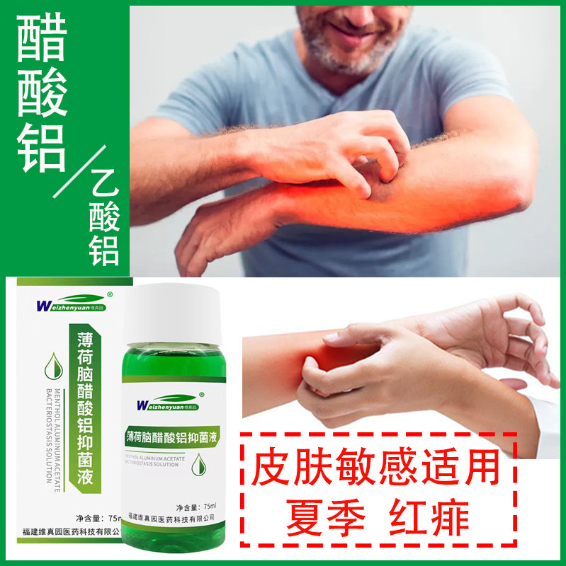 维真园止痒红疹皮肤擦剂