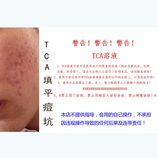 tca溶液三氯乙酸 痘坑浅层换肤女学生tca溶液PEEL CROSS高度