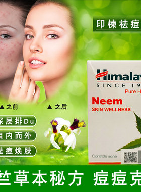 印度喜马拉雅痘痘痤疮片印楝neem草本一手原装正品