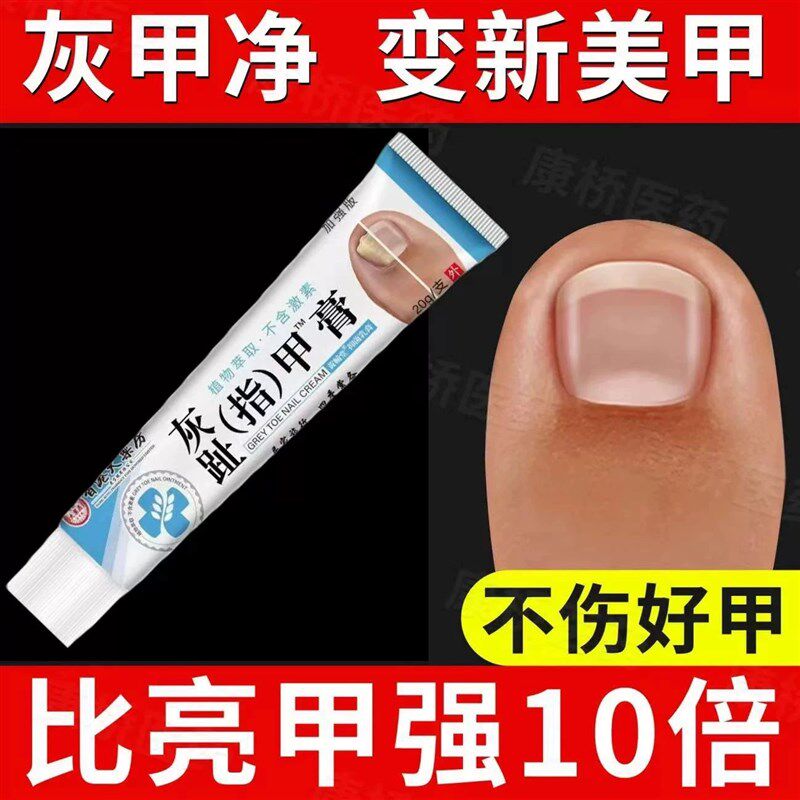 【香港药房】灰指甲专用严重甲沟炎指甲发黄增厚抑菌亮甲草本药膏