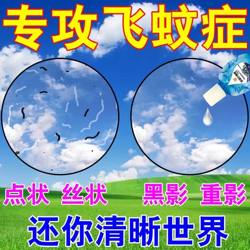 飞蚊症专用滴眼液治疗眼前黑影飘动重影视线模糊眼睛干涩痒