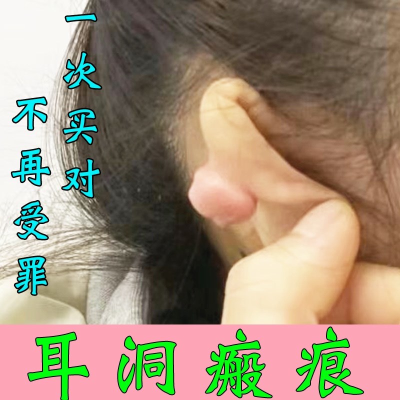耳朵疙瘩胸前增生凸起软化针去除修复膏祛伤疤痕贴夹耳洞消除增生