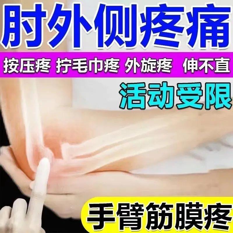 胳膊肘疼伸不直手臂筋膜疼肘关节胳膊筋疼手臂肌肉疼僵硬疼膏贴