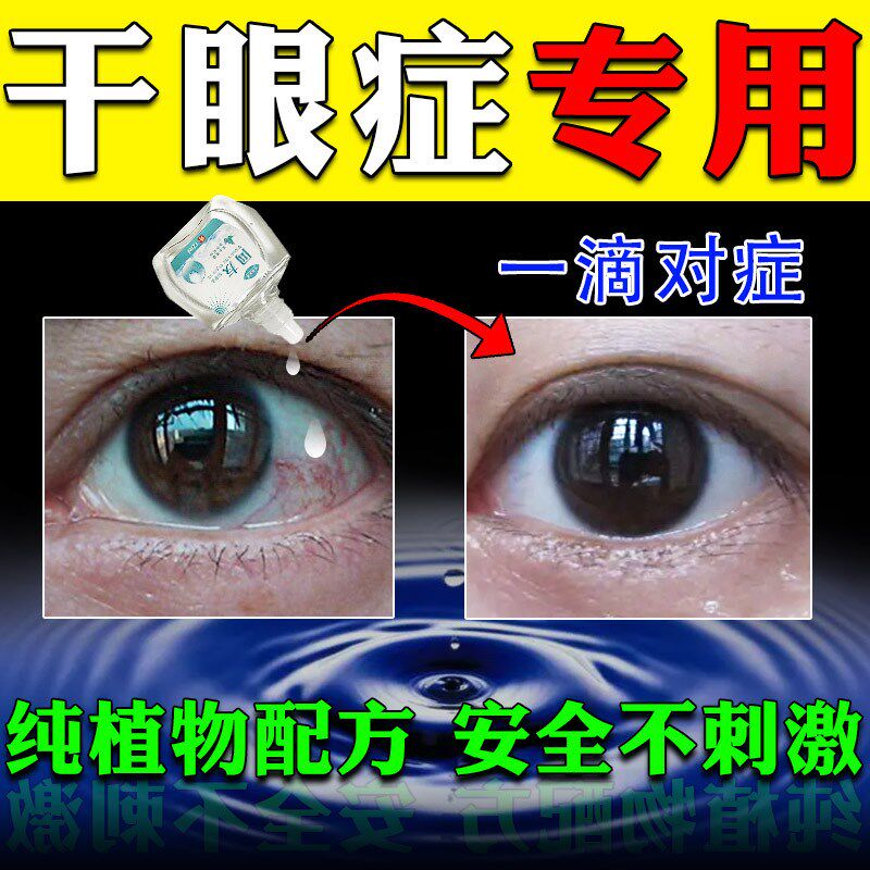 治干眼症滴眼液眼睛干涩有异物感视力模糊缓解疲劳眼水眼睑水肿