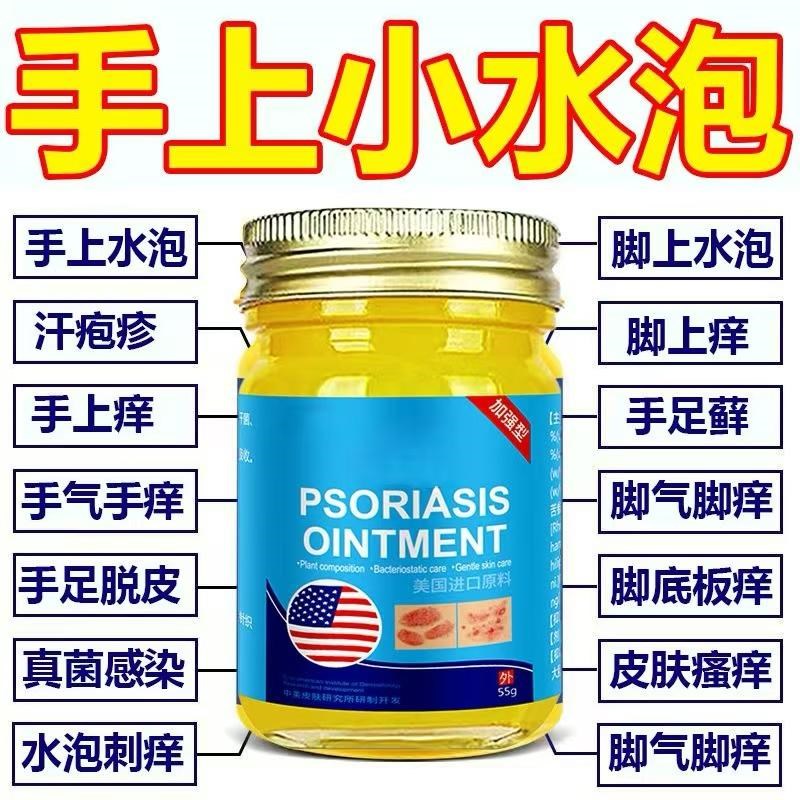手足脱皮止痒膏皮肤干燥瘙痒手足癣真菌感染鹅掌顽固性手足癣专用