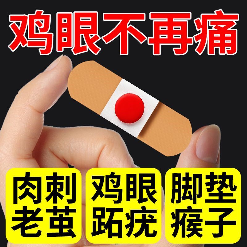 去除鸡眼贴老茧刺瘊刺窝脚钉脚茧脚垫鸡眼贴鸡眼膏除茧贴包邮