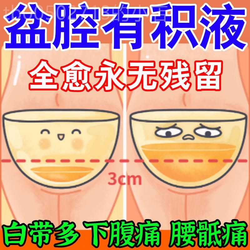 盆腔积液积水热敷包附件炎内膜异味盆腔深处暗区腰骶酸疼小腹痛贴