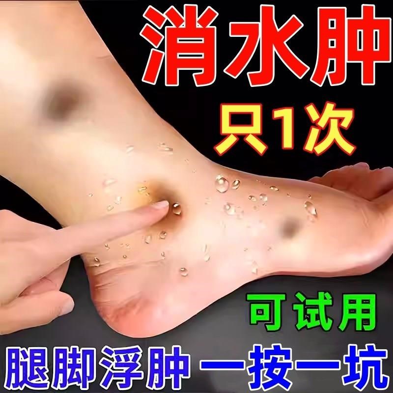 去水肿泡脚药包消肿腿肿胀下肢水肿全身水肿浮肿脚肿泡脚药包消肿