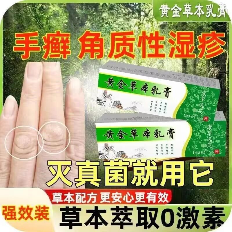 癣脚膏药风掌鹅膏痒止疹湿裂干皮脱痒手泡水染感菌真癣足手膏癣手