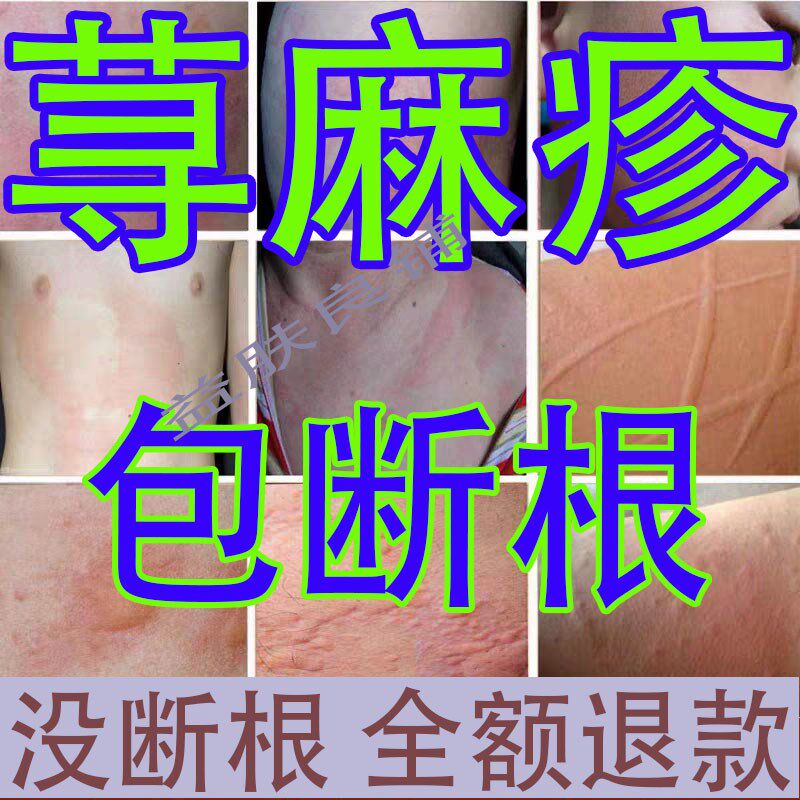 【已治65324651人使用】限时活动进行中~买二送一~用过都说好!